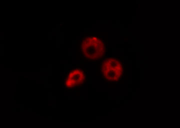 TFE3 Antibody - Staining K562 cells by IF/ICC. The samples were fixed with PFA and permeabilized in 0.1% Triton X-100, then blocked in 10% serum for 45 min at 25°C. The primary antibody was diluted at 1:200 and incubated with the sample for 1 hour at 37°C. An Alexa Fluor 594 conjugated goat anti-rabbit IgG (H+L) Ab, diluted at 1/600, was used as the secondary antibody.