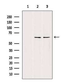 TFE3 Antibody - Western blot analysis of extracts of various samples using TFE3 antibody. Lane 1: mouse carcinoma treated with blocking peptide. Lane 2: mouse carcinoma; Lane 3: HeLa;