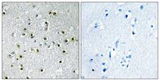 TFE3 Antibody - Peptide - + Immunohistochemistry analysis of paraffin-embedded human brain tissue using TFE3 antibody.