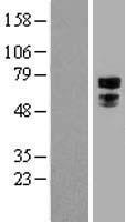 TFE3 Protein - Western validation with an anti-DDK antibody * L: Control HEK293 lysate R: Over-expression lysate