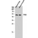 TFEB Antibody - Western blot of TFEB antibody