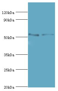 TFEB Antibody - Western blot. All lanes: Transcription factor EB antibody at 3 ug/ml. Lane 1: Jurkat whole cell lysate. Lane 2: mouse brain tissue. Secondary antibody: Goat polyclonal to rabbit at 1:10000 dilution. Predicted band size: 53 kDa. Observed band size: 53 kDa Immunohistochemistry.