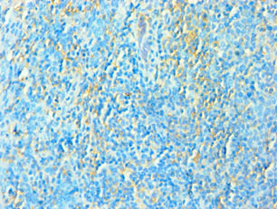 TFEB Antibody - Immunohistochemistry of paraffin-embedded human tonsil tissue using TFEB Antibody at dilution of 1:100