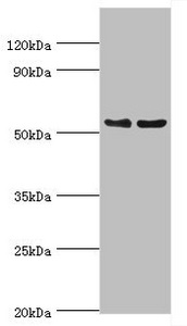 TFEB Antibody - Western blot All lanes: Transcription factor EB antibody at 3µg/ml Lane 1: Jurkat whole cell lysate Lane 2: Mouse brain tissue Secondary Goat polyclonal to rabbit IgG at 1/10000 dilution Predicted band size: 53, 44 kDa Observed band size: 53 kDa