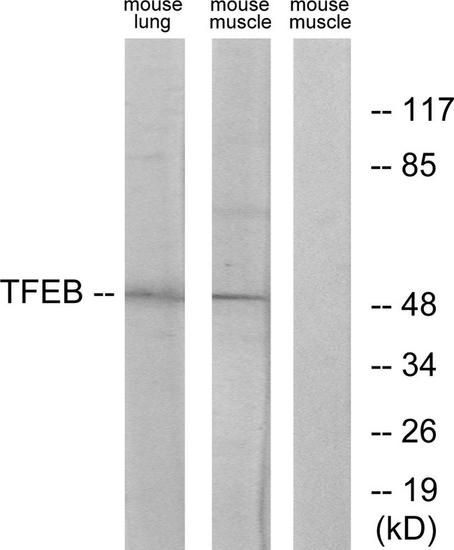 TFEB Antibody - Western blot analysis of lysates from mouse lung and mouse muscle cells, using TFEB Antibody. The lane on the right is blocked with the synthesized peptide.