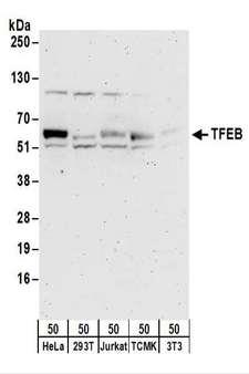 TFEB Antibody - Detection of Human and Mouse TFEB by Western Blot. Samples: Whole cell lysate (50 ug) from HeLa, 293T, Jurkat, TCMK-1, and NIH3T3 cells. Antibodies: Affinity purified rabbit anti-TFEB antibody used for WB at 0.1 ug/ml. Detection: Chemiluminescence with an exposure time of 3 minutes.