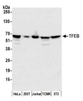 TFEB Antibody - Detection of human and mouse TFEB by western blot. Samples: Whole cell lysate (50 µg) from HeLa, HEK293T, Jurkat, mouse TCMK-1, and mouse NIH 3T3 cells prepared using NETN lysis buffer. Antibody: Affinity purified rabbit anti-TFEB antibody used for WB at 0.1 µg/ml. Detection: Chemiluminescence with an exposure time of 30 seconds.
