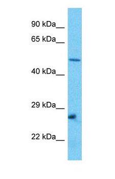 TFEB Antibody - Western blot of TFEB Antibody with Jurkat Whole Cell lysate.  This image was taken for the unconjugated form of this product. Other forms have not been tested.