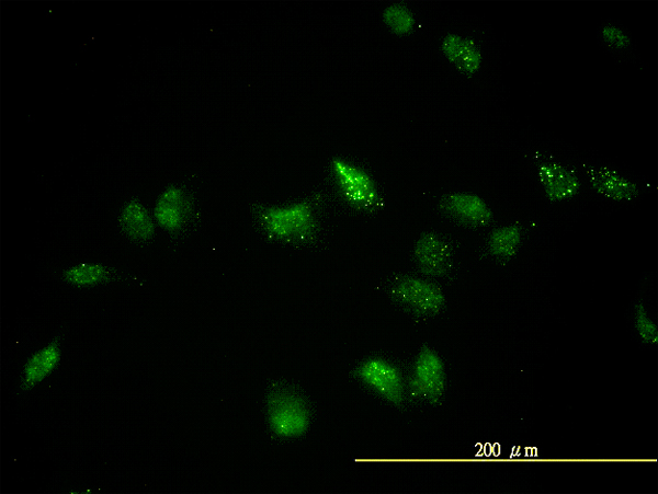 TFEB Antibody - Immunofluorescence of monoclonal antibody to TFEB on HeLa cell. [antibody concentration 20 ug/ml]