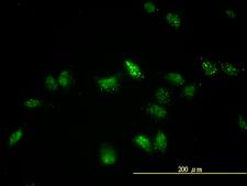 TFEB Antibody - Immunofluorescence of monoclonal antibody to TFEB on HeLa cell. [antibody concentration 20 ug/ml]