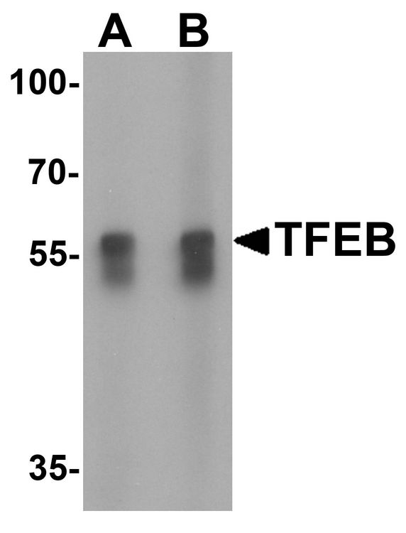 TFEB Antibody - Western blot analysis of TFEB in A549 cell lysate with TFEB antibody at (A) 1 and (B) 2 ug/ml.