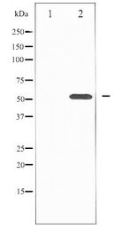 TFEB Antibody - Western blot of TFEB expression in Mouse lung tissue lysates,The lane on the left is treated with the antigen-specific peptide.
