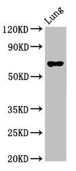 TFEB Antibody - Western Blot Positive WB detected in: Rat lung tissue All lanes: TFEB antibody at 3µg/ml Secondary Goat polyclonal to rabbit IgG at 1/50000 dilution Predicted band size: 53, 44 kDa Observed band size: 70 kDa