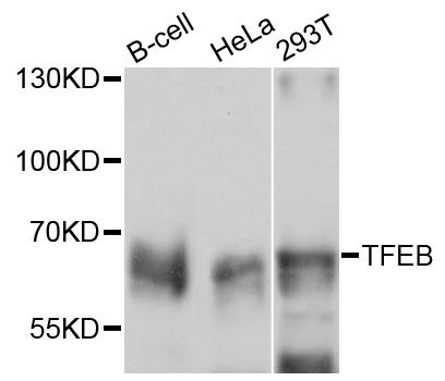 TFEB Antibody - Western blot analysis of extracts of various cell lines, using TFEB antibody at 1:1000 dilution. The secondary antibody used was an HRP Goat Anti-Rabbit IgG (H+L) at 1:10000 dilution. Lysates were loaded 25ug per lane and 3% nonfat dry milk in TBST was used for blocking. An ECL Kit was used for detection and the exposure time was 5s.