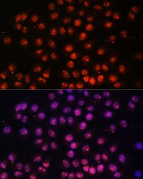 TFEB Antibody - Immunofluorescence analysis of HeLa cells using TFEB Polyclonal Antibody at dilution of 1:100.Blue: DAPI for nuclear staining.