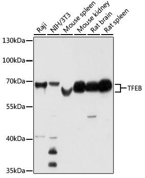 TFEB Antibody - Western blot analysis of extracts of various cell lines using TFEB Polyclonal Antibody at dilution of 1:1000.