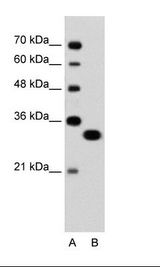 TFEC Antibody - A: Marker, B: Jurkat Cell Lysate.  This image was taken for the unconjugated form of this product. Other forms have not been tested.