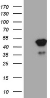 TFEC Antibody - HEK293T cells were transfected with the pCMV6-ENTRY control. (Left lane) or pCMV6-ENTRY TFEC. (Right lane) cDNA for 48 hrs and lysed. Equivalent amounts of cell lysates. (5 ug per lane) were separated by SDS-PAGE and immunoblotted with anti-TFEC. (1:2000)