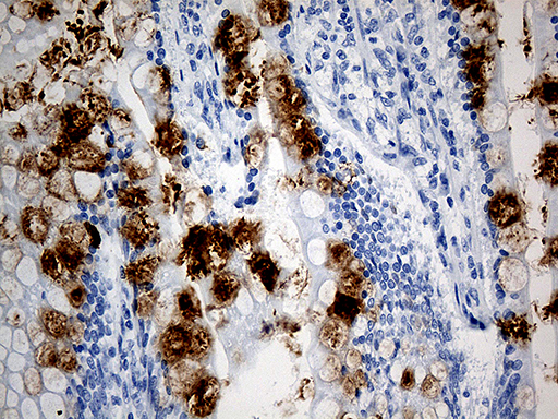 TFF1 / pS2 Antibody - Immunohistochemical staining of paraffin-embedded Human colon tissue within the normal limits using anti-TFF1 mouse monoclonal antibody. (Heat-induced epitope retrieval by 1mM EDTA in 10mM Tris buffer. (pH8.5) at 120°C for 3 min. (1:500)