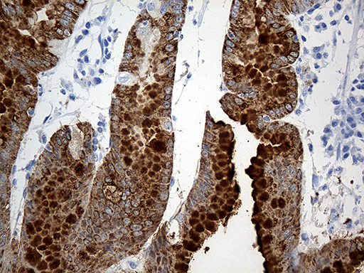 TFF1 / pS2 Antibody - Immunohistochemical staining of paraffin-embedded Human gastric tissue within the normal limits using anti-TFF1 mouse monoclonal antibody. (Heat-induced epitope retrieval by 1mM EDTA in 10mM Tris buffer. (pH8.5) at 120°C for 3 min. (1:500)