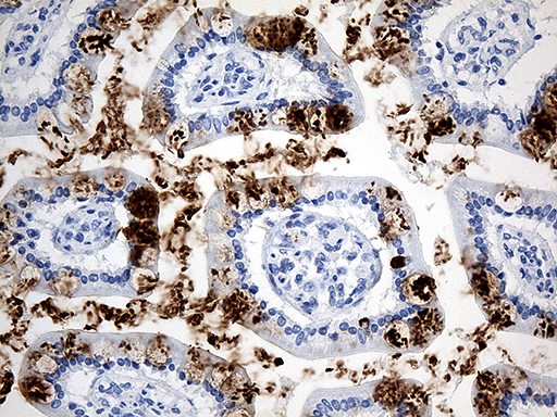 TFF1 / pS2 Antibody - Immunohistochemical staining of paraffin-embedded Human colon tissue within the normal limits using anti-TFF1 mouse monoclonal antibody. (Heat-induced epitope retrieval by 1mM EDTA in 10mM Tris buffer. (pH8.5) at 120°C for 3 min. (1:150)