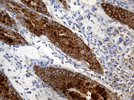 TFF1 / pS2 Antibody - Immunohistochemical staining of paraffin-embedded Human gastric tissue within the normal limits using anti-TFF1 mouse monoclonal antibody. (Heat-induced epitope retrieval by 1mM EDTA in 10mM Tris buffer. (pH8.5) at 120°C for 3 min. (1:150)