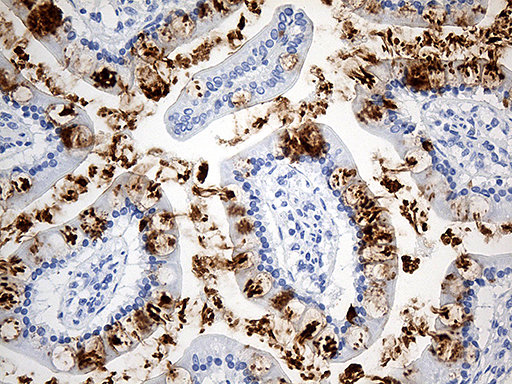 TFF1 / pS2 Antibody - Immunohistochemical staining of paraffin-embedded Human colon tissue within the normal limits using anti-TFF1 mouse monoclonal antibody. (Heat-induced epitope retrieval by 1mM EDTA in 10mM Tris buffer. (pH8.5) at 120°C for 3 min. (1:150)