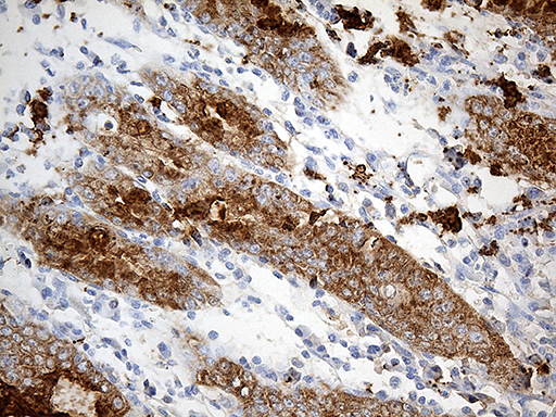 TFF1 / pS2 Antibody - Immunohistochemical staining of paraffin-embedded Human gastric tissue within the normal limits using anti-TFF1 mouse monoclonal antibody. (Heat-induced epitope retrieval by 1mM EDTA in 10mM Tris buffer. (pH8.5) at 120°C for 3 min. (1:150)