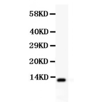 TFF1 / pS2 Antibody - TFF1 antibody Western blot. All lanes: Anti TFF1 at 0.5 ug/ml. WB: HELA Whole Cell Lysate at 40 ug. Predicted band size: 12 kD. Observed band size: 12 kD.