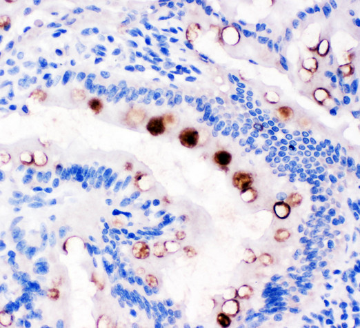 TFF1 / pS2 Antibody - TFF1 / PS2 antibody. IHC(P): Rat Intestine Tissue.
