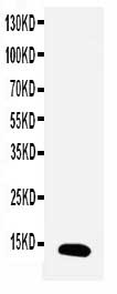 TFF1 / pS2 Antibody - WB of TFF1 / PS2 antibody. All lanes: Anti-TFF1 at 0.5ug/ml. WB: MCF-7 Whole Cell Lysate at 40ug. Predicted bind size: 9KD. Observed bind size: 12KD.