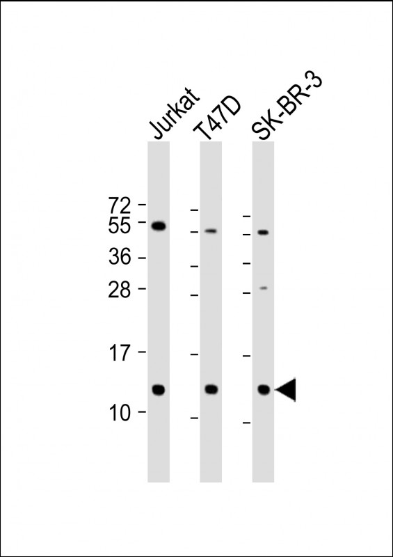 TFF1 / pS2 Antibody - All lanes: Anti-TFF1 Antibody (Center) at 1:2000 dilution Lane 1: Jurkat whole cell lysate Lane 2: T47D whole cell lysate Lane 3: SK-BR-3 whole cell lysate Lysates/proteins at 20 µg per lane. Secondary Goat Anti-Rabbit IgG, (H+L), Peroxidase conjugated at 1/10000 dilution. Predicted band size: 9 kDa Blocking/Dilution buffer: 5% NFDM/TBST.