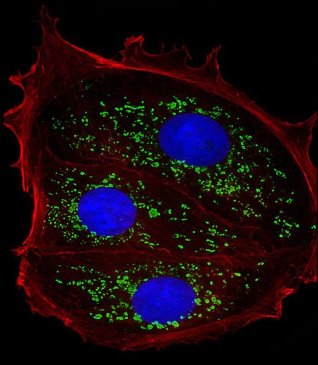 TFF1 / pS2 Antibody - Immunofluorescent analysis of 4% paraformaldehyde-fixed, 0.1% Triton X-100 permeabilized MCF-7 (human breast cancer cell line) cells labeling TFF1 with TFF1 Antibody (Center) at 1/25 dilution, followed by Dylight® 488-conjugated goat anti-rabbit IgG (NK179883) secondary antibody at 1/200 dilution (green). Immunofluorescence image showing secreted staining on MCF-7 cell line. The nuclear counter stain is DAPI (blue).