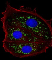 TFF1 / pS2 Antibody - Immunofluorescent analysis of 4% paraformaldehyde-fixed, 0.1% Triton X-100 permeabilized MCF-7 (human breast cancer cell line) cells labeling TFF1 with TFF1 Antibody (Center) at 1/25 dilution, followed by Dylight® 488-conjugated goat anti-rabbit IgG (NK179883) secondary antibody at 1/200 dilution (green). Immunofluorescence image showing secreted staining on MCF-7 cell line. The nuclear counter stain is DAPI (blue).