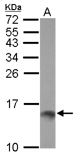 TFF1 / pS2 Antibody - Sample (30 ug of whole cell lysate) A: MCF-7 15% SDS PAGE TFF1 antibody diluted at 1:500