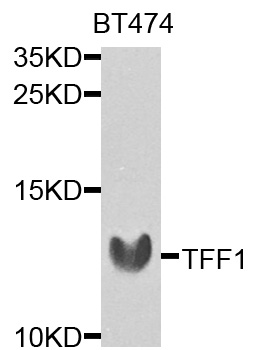 TFF1 / pS2 Antibody - Western blot analysis of extracts of BT-474 cells, using TFF1 antibody at 1:1000 dilution. The secondary antibody used was an HRP Goat Anti-Rabbit IgG (H+L) at 1:10000 dilution. Lysates were loaded 25ug per lane and 3% nonfat dry milk in TBST was used for blocking. An ECL Kit was used for detection and the exposure time was 90s.