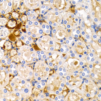TFF1 / pS2 Antibody - Immunohistochemistry of paraffin-embedded rat kidney using TFF1 antibodyat dilution of 1:200 (40x lens).
