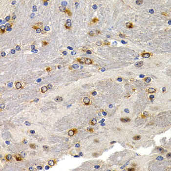 TFF1 / pS2 Antibody - Immunohistochemistry of paraffin-embedded mouse brain using TFF1 antibodyat dilution of 1:200 (40x lens).