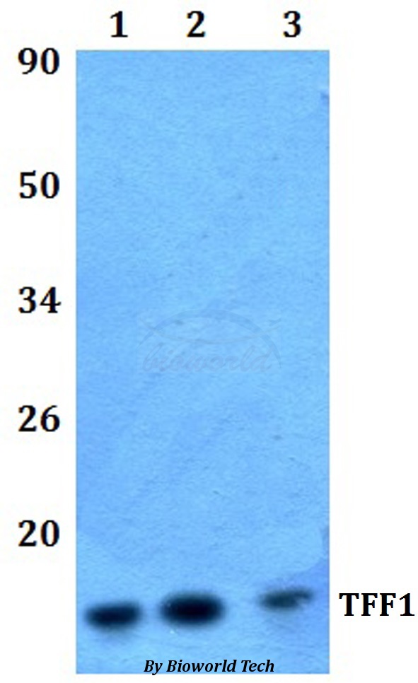 TFF1 / pS2 Antibody - Western blot of TFF1 antibody at 1:500 dilution. Lane 1: RAW264.7 whole cell lysate.