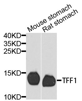 TFF1 / pS2 Antibody - Western blot analysis of extracts of various cell lines, using TFF1 antibody at 1:1000 dilution. The secondary antibody used was an HRP Goat Anti-Rabbit IgG (H+L) at 1:10000 dilution. Lysates were loaded 25ug per lane and 3% nonfat dry milk in TBST was used for blocking. An ECL Kit was used for detection and the exposure time was 90s.