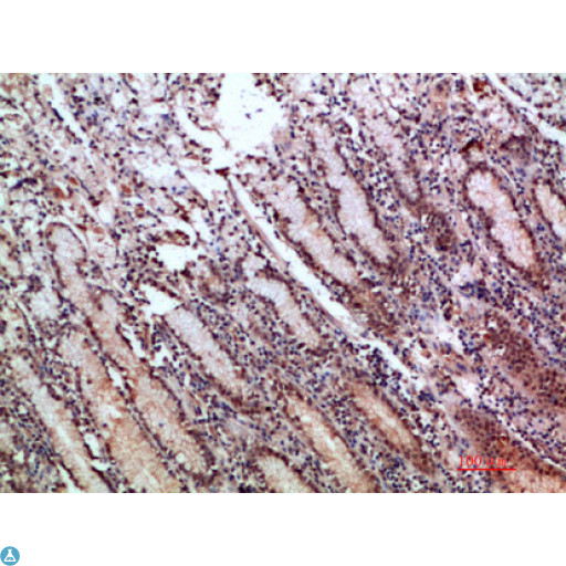 TFF1 / pS2 Antibody - Immunohistochemical analysis of paraffin-embedded human-stomach, antibody was diluted at 1:200.