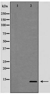 TFF2 / SP Antibody - Western blot of Trefoil factor 2 expression in HeLa cells