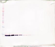 TFF2 / SP Antibody - Anti-Human TFF-2 Western Blot Reduced