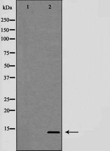 TFF2 / SP Antibody - Western blot analysis of Trefoil factor 2 (TFF2) expression in HeLa cells. The lane on the left is treated with the antigen-specific peptide.