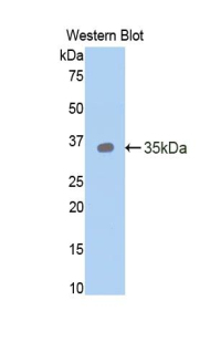 TFF3 / Trefoil Factor 3 Antibody - Western blot of recombinant TFF3 / Trefoil Factor 3.  This image was taken for the unconjugated form of this product. Other forms have not been tested.