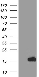 TFF3 / Trefoil Factor 3 Antibody - HEK293T cells were transfected with the pCMV6-ENTRY control. (Left lane) or pCMV6-ENTRY TFF3. (Right lane) cDNA for 48 hrs and lysed. Equivalent amounts of cell lysates. (5 ug per lane) were separated by SDS-PAGE and immunoblotted with anti-TFF3. (1:500)