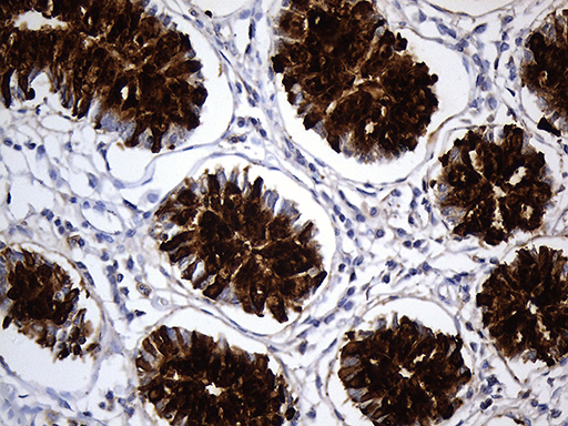 TFF3 / Trefoil Factor 3 Antibody - Immunohistochemical staining of paraffin-embedded Human colon tissue within the normal limits using anti-TFF3 mouse monoclonal antibody. (Heat-induced epitope retrieval by 1mM EDTA in 10mM Tris buffer. (pH8.5) at 120°C for 3 min. (1:500)