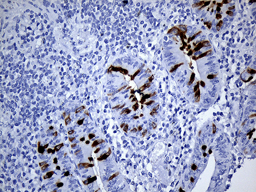 TFF3 / Trefoil Factor 3 Antibody - Immunohistochemical staining of paraffin-embedded Human appendix tissue within the normal limits using anti-TFF3 mouse monoclonal antibody. (Heat-induced epitope retrieval by 1mM EDTA in 10mM Tris buffer. (pH8.5) at 120°C for 3 min. (1:500)