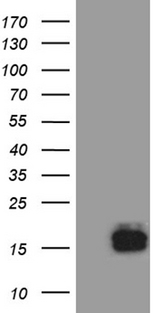 TFF3 / Trefoil Factor 3 Antibody - HEK293T cells were transfected with the pCMV6-ENTRY control. (Left lane) or pCMV6-ENTRY TFF3. (Right lane) cDNA for 48 hrs and lysed. Equivalent amounts of cell lysates. (5 ug per lane) were separated by SDS-PAGE and immunoblotted with anti-TFF3. (1:2000)