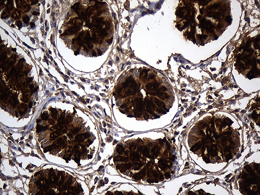 TFF3 / Trefoil Factor 3 Antibody - Immunohistochemical staining of paraffin-embedded Human colon tissue within the normal limits using anti-TFF3 mouse monoclonal antibody. (Heat-induced epitope retrieval by 1mM EDTA in 10mM Tris buffer. (pH8.5) at 120°C for 3 min. (1:500)